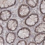 AP3B1 Antibody in Immunohistochemistry (IHC)