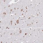 RPL13A Antibody in Immunohistochemistry (Paraffin) (IHC (P))