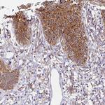 RPL13A Antibody in Immunohistochemistry (Paraffin) (IHC (P))