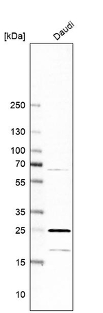 RPL13A Antibody in Western Blot (WB)