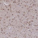 ARL8A Polyclonal Antibody