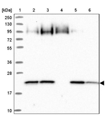 ARL8A Antibody in Western Blot (WB)