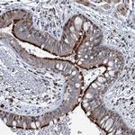 MRPL14 Antibody in Immunohistochemistry (Paraffin) (IHC (P))