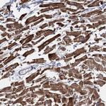 EYA4 Polyclonal Antibody