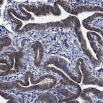 EYA4 Antibody in Immunohistochemistry (Paraffin) (IHC (P))