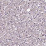 FUNDC1 Antibody in Immunohistochemistry (IHC)