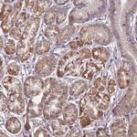 FUNDC1 Antibody in Immunohistochemistry (IHC)