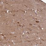 FUNDC1 Antibody in Immunohistochemistry (IHC)