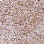 FUNDC1 Polyclonal Antibody