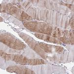 LRRC38 Antibody in Immunohistochemistry (Paraffin) (IHC (P))