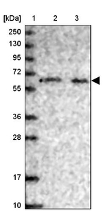 PHF8 Antibody in Western Blot (WB)