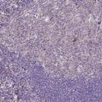 CD99L2 Antibody in Immunohistochemistry (IHC)