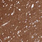 CD99L2 Antibody in Immunohistochemistry (Paraffin) (IHC (P))