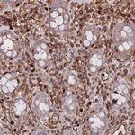 CD99L2 Antibody in Immunohistochemistry (Paraffin) (IHC (P))