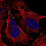 TMEM164 Polyclonal Antibody