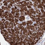 TMEM164 Antibody in Immunohistochemistry (Paraffin) (IHC (P))