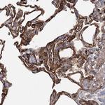 TMEM164 Antibody in Immunohistochemistry (Paraffin) (IHC (P))