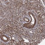 TMEM164 Antibody in Immunohistochemistry (Paraffin) (IHC (P))