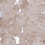 TMEM164 Antibody in Immunohistochemistry (Paraffin) (IHC (P))