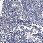MURF2 Antibody in Immunohistochemistry (Paraffin) (IHC (P))