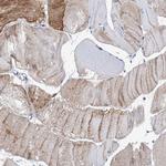 MURF2 Antibody in Immunohistochemistry (Paraffin) (IHC (P))