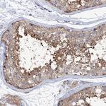 MURF2 Polyclonal Antibody