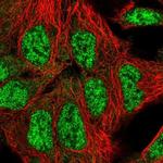 SFRS18 Polyclonal Antibody