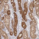 SFRS18 Antibody in Immunohistochemistry (Paraffin) (IHC (P))