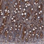 RUFY1 Antibody in Immunohistochemistry (IHC)