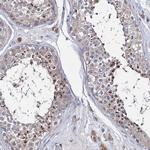 LYZL4 Polyclonal Antibody