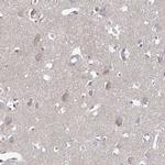 RICH2 Polyclonal Antibody