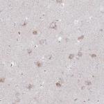 NAGLU Polyclonal Antibody