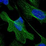 BRINP1 Polyclonal Antibody