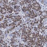 BRINP1 Antibody in Immunohistochemistry (Paraffin) (IHC (P))