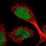 C1orf86 Polyclonal Antibody