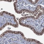 RASSF4 Antibody in Immunohistochemistry (Paraffin) (IHC (P))