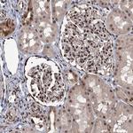RASSF4 Antibody in Immunohistochemistry (Paraffin) (IHC (P))
