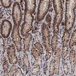 RASSF4 Antibody in Immunohistochemistry (Paraffin) (IHC (P))