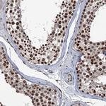 RASSF4 Antibody in Immunohistochemistry (Paraffin) (IHC (P))