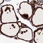 ZC3H12C Polyclonal Antibody