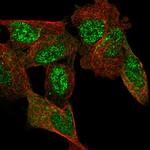 C11orf96 Polyclonal Antibody