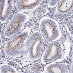 C11orf96 Antibody in Immunohistochemistry (Paraffin) (IHC (P))