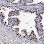 C11orf96 Antibody in Immunohistochemistry (Paraffin) (IHC (P))