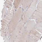 C11orf96 Antibody in Immunohistochemistry (Paraffin) (IHC (P))