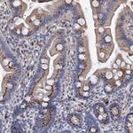 C11orf96 Antibody in Immunohistochemistry (Paraffin) (IHC (P))