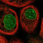 CCDC77 Polyclonal Antibody