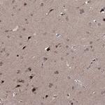 CCDC77 Antibody in Immunohistochemistry (Paraffin) (IHC (P))