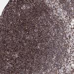 CCDC77 Antibody in Immunohistochemistry (Paraffin) (IHC (P))