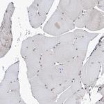 CCDC77 Antibody in Immunohistochemistry (Paraffin) (IHC (P))
