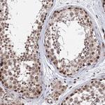 CCDC77 Antibody in Immunohistochemistry (Paraffin) (IHC (P))